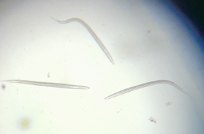 6-day old L3 Necator americanus larvae from a home incubation